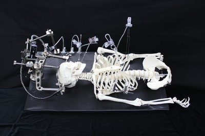 Skeleton